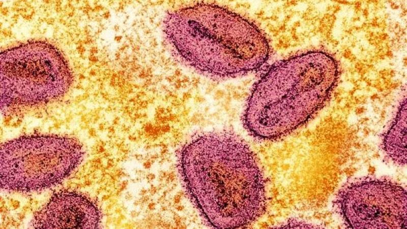 New Variant of Mpox Detected in Mozambique New Variant of Mpox Detected in Mozambique
