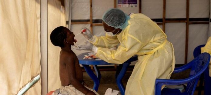 Mpox Outbreak in Namibia: Country in High Alert